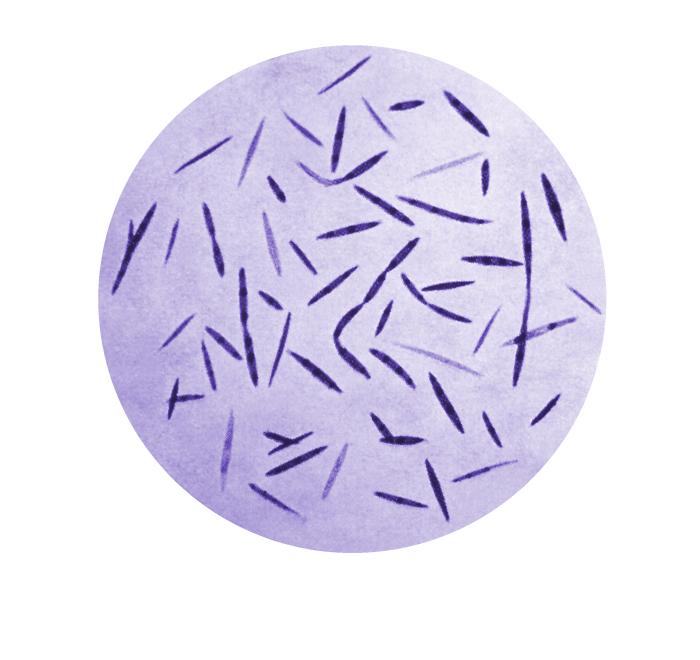 Gram-negative Fusobacterium plauti-vincenti bacteria. From Public Health Image Library (PHIL). [10]