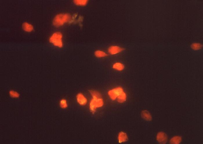 This photomicrograph depicts Giardia lamblia parasites using indirect immunofluorescence test for giardiasis. From Public Health Image Library (PHIL). [9]