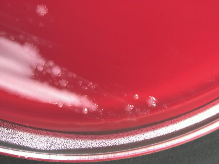 Low-power magnification of 10X of a digital Keyence scope, this photograph depicts the colonial growth displayed by Pasteur strain members of the Gram-positive bacterium, Bacillus anthracis, which were cultured on colistin-naladixic acid agar (CNA) medium, for a 24 hour time period, at a temperature of 37°C. ”Adapted from Public Health Image Library (PHIL), Centers for Disease Control and Prevention.[20]