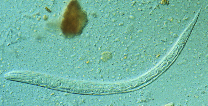First stage larva (L1) of S. stercoralis