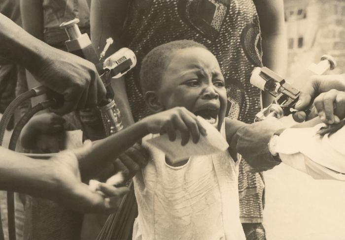 African Cameroonian boy in the process of receiving his vaccinations during the African Smallpox Eradication and Measles Control Program.Adapted from Public Health Image Library (PHIL), Centers for Disease Control and Prevention.[14]