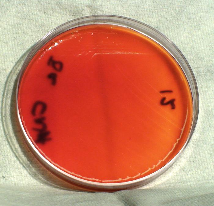 Light colonial growth displayed by Gram-positive, Pasteur strain, Bacillus anthracis bacteria, which was grown on a medium of CNA agar, for a 24 hour time period, at a temperature of 37°C.”Adapted from Public Health Image Library (PHIL), Centers for Disease Control and Prevention.[21]