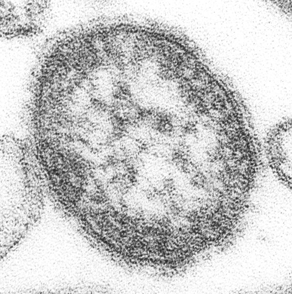 Measles virus electron micrograph