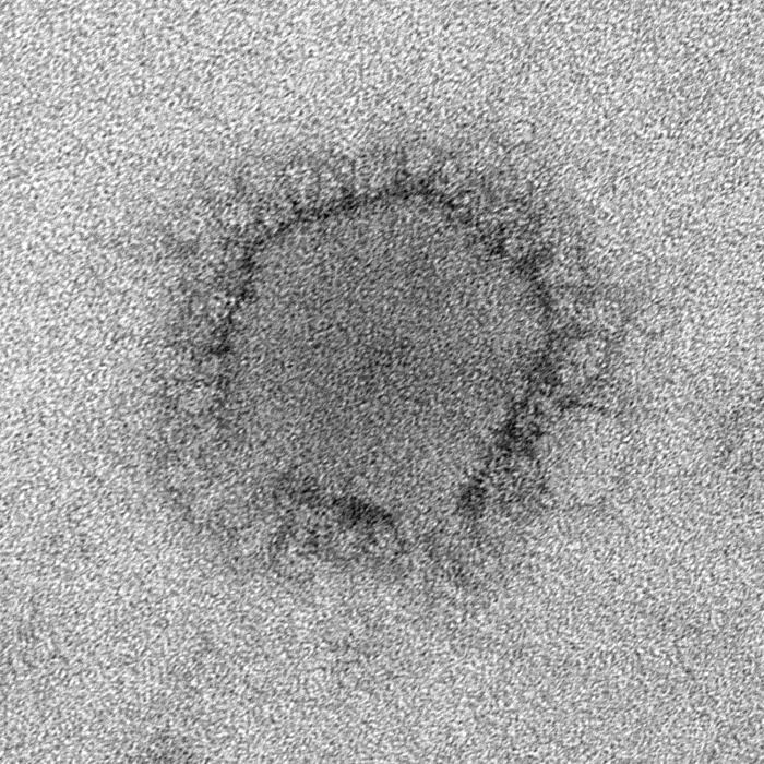 TEM reveals ultrastructural morphology of the Middle East Respiratory Syndrome Coronavirus (MERS-CoV). From Public Health Image Library (PHIL). [1]
