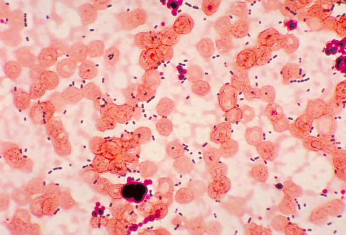 Photomicrograph reveals cocci-shaped Enterococcus sp. bacteria taken from a pneumonia patient. From Public Health Image Library (PHIL). [10]