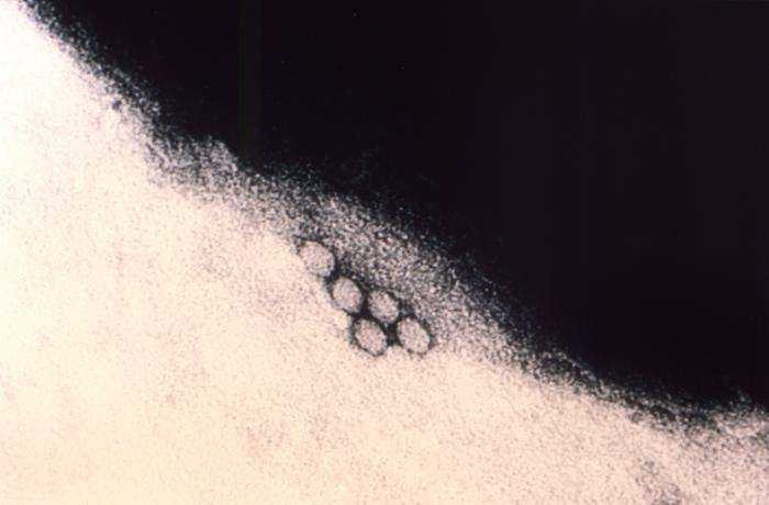 ransmission electron micrograph (TEM) depicts a number of virions found responsible for a case of acute hemorrhagic conjunctivitis (AHC).From Public Health Image Library (PHIL). [27]
