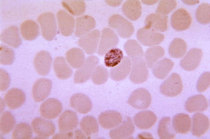 Thin film blood smear micrograph depicts an immature Plasmodium malariae schizont, displaying four cytoplasmic chromatin masses Adapted from Public Health Image Library (PHIL), Centers for Disease Control and Prevention.[6]