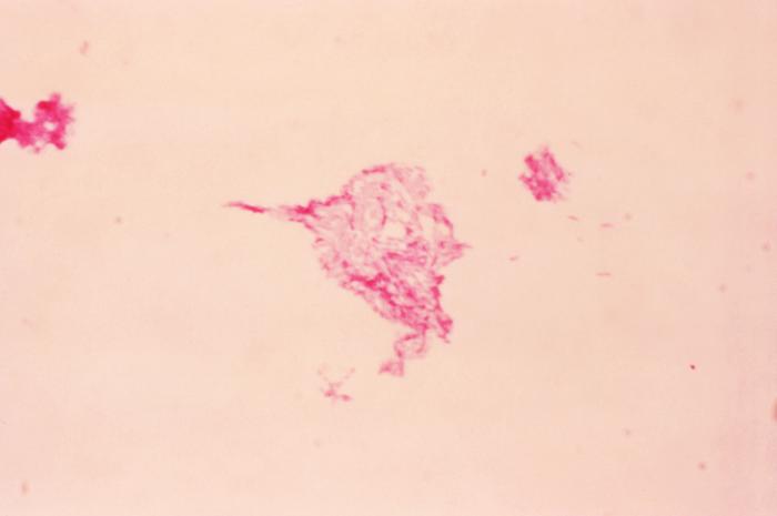 Photomicrograph of a rabbit blood culture showing Haemophilus ducreyi bacteria using Gram-stain technique. From Public Health Image Library (PHIL). [4]