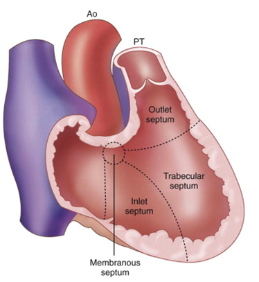 File:The morphology of Ventricular septum.png