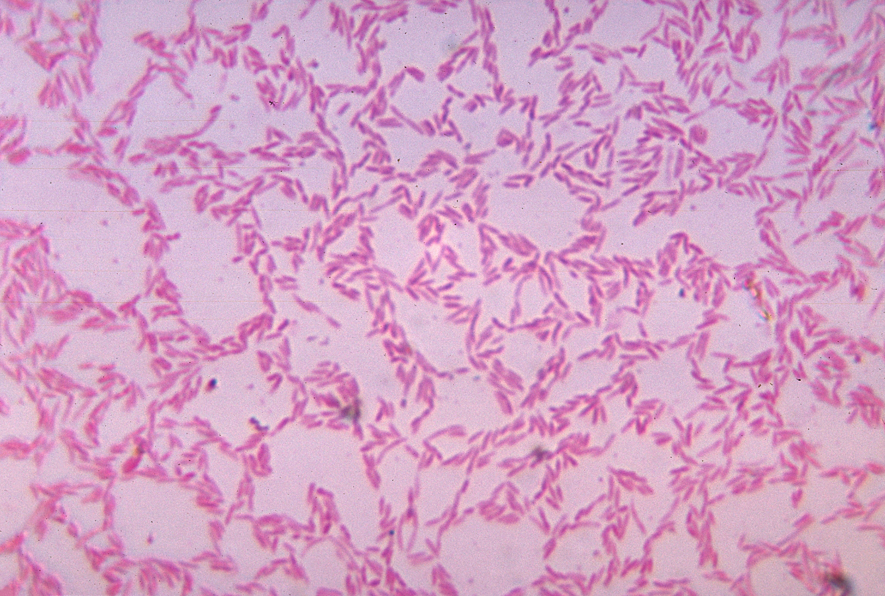 Bacteroides spp. anaerobically cultured in blood agar medium.