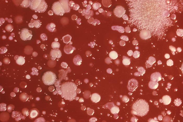 "Blood agar culture plate growing B. anthracis and other soil flora.” Adapted from Public Health Image Library (PHIL), Centers for Disease Control and Prevention.[21]