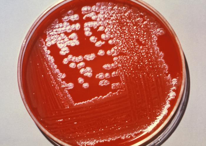 Agar culture plate is growing Bacillus anthracis colonies.”Adapted from Public Health Image Library (PHIL), Centers for Disease Control and Prevention.[20]