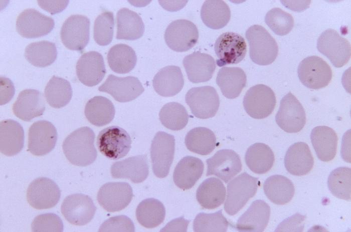Thin film blood smear micrograph depicts two Plasmodium malariae schizonts Adapted from Public Health Image Library (PHIL), Centers for Disease Control and Prevention.[6]