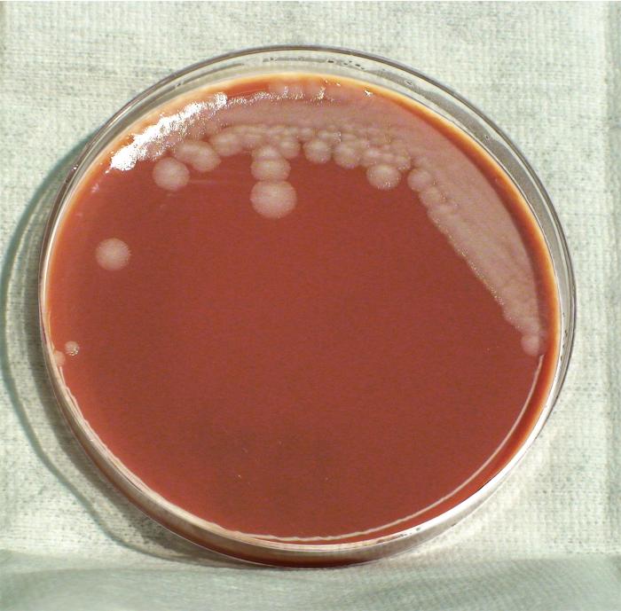 Colonial morphology displayed by Gram-positive, Pasteur strain, Bacillus anthracis bacteria, which was grown on a medium of chocolate agar, for a 24 hour time period, at a temperature of 37°C.”Adapted from Public Health Image Library (PHIL), Centers for Disease Control and Prevention.[21]
