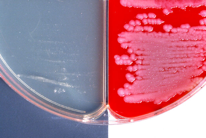 "Bacillus anthracis positive encapsulation test is demonstrated using two different agar media”Adapted from Public Health Image Library (PHIL), Centers for Disease Control and Prevention.[20]