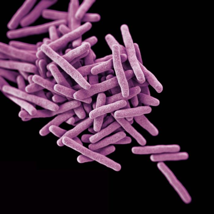 File:M.tuberculosis1.jpg