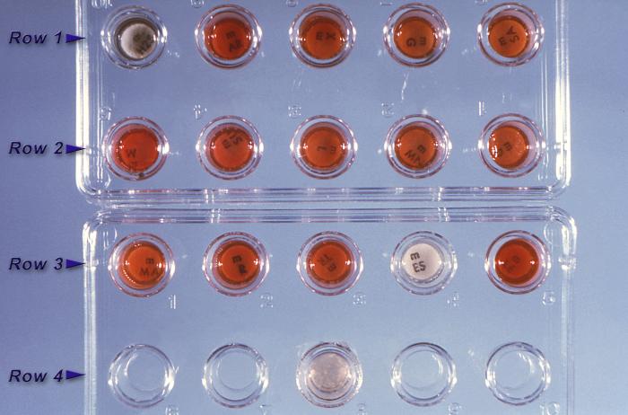 Minitek® (BD Biosciences) anaerobe identification kit, shows Gram-negative Fusobacterium nucleatum bacteria. From Public Health Image Library (PHIL). [10]