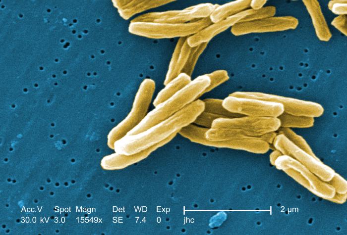 Gram-positive Mycobacterium tuberculosis bacteria. From Public Health Image Library (PHIL). [2]