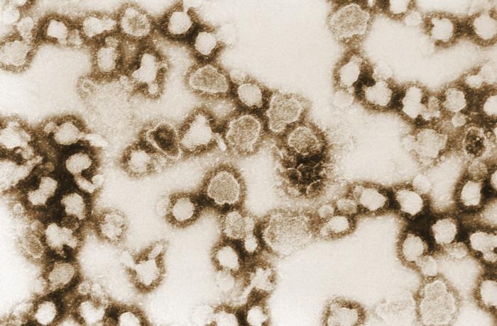 This electron micrograph reveals the morphologic traits of the La Crosse encephalitis virus, a Bunyaviridae virus family member. From Public Health Image Library (PHIL). [15]