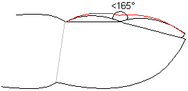 Clubbing of the fingernail. The red line shows the outline of a clubbed nail.