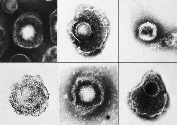 Various viruses from the Herpesviridae family seen using an electron micrograph. From Public Health Image Library (PHIL). [27]
