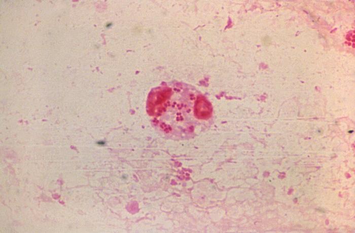 Photomicrograph reveals Gram-negative rods, and Gram-negative cocci, which were determined to be Haemophilus influenzae, and non-meningococcal Neisseria sp. organisms respectively (1000X mag). From Public Health Image Library (PHIL). [9]