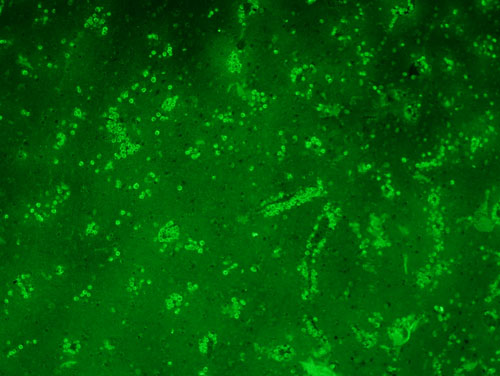 A section of the brain of a PAM case reacted with the specific anti-Naegleria fowleri antibody. Note the large numbers of Naegleria fowleri trophozoites staining bright green. No cysts are seen.