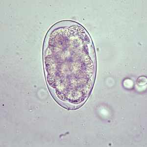 File:Oesophagostomum egg B.jpg