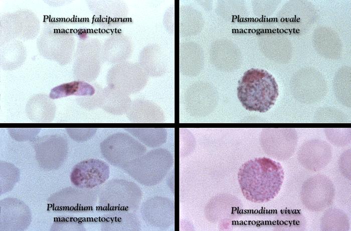 This Giemsa stained slide reveals a P. falciparum, P. ovale, P. malariae, P. vivax, gametocyte Adapted from Public Health Image Library (PHIL), Centers for Disease Control and Prevention.[6]