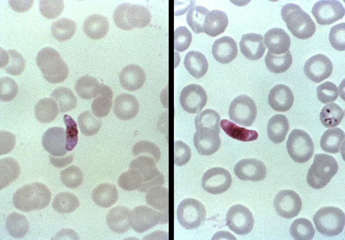 File:Malaria54.jpg