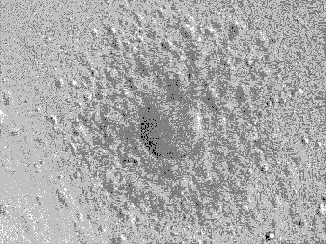 Oocyte granulosa cells