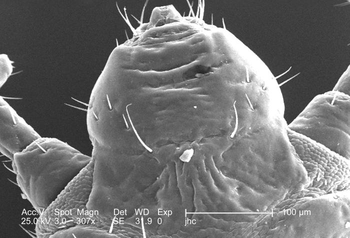 Scanning electron micrographic (SEM) image focused on the head region of a female body louse, Pediculus humanus var. corporis from a ventral perspective. SEM reveals some of the insect’s exoskeletal morphology exhibited by the cephalic region (307X mag). From Public Health Image Library (PHIL). [1]