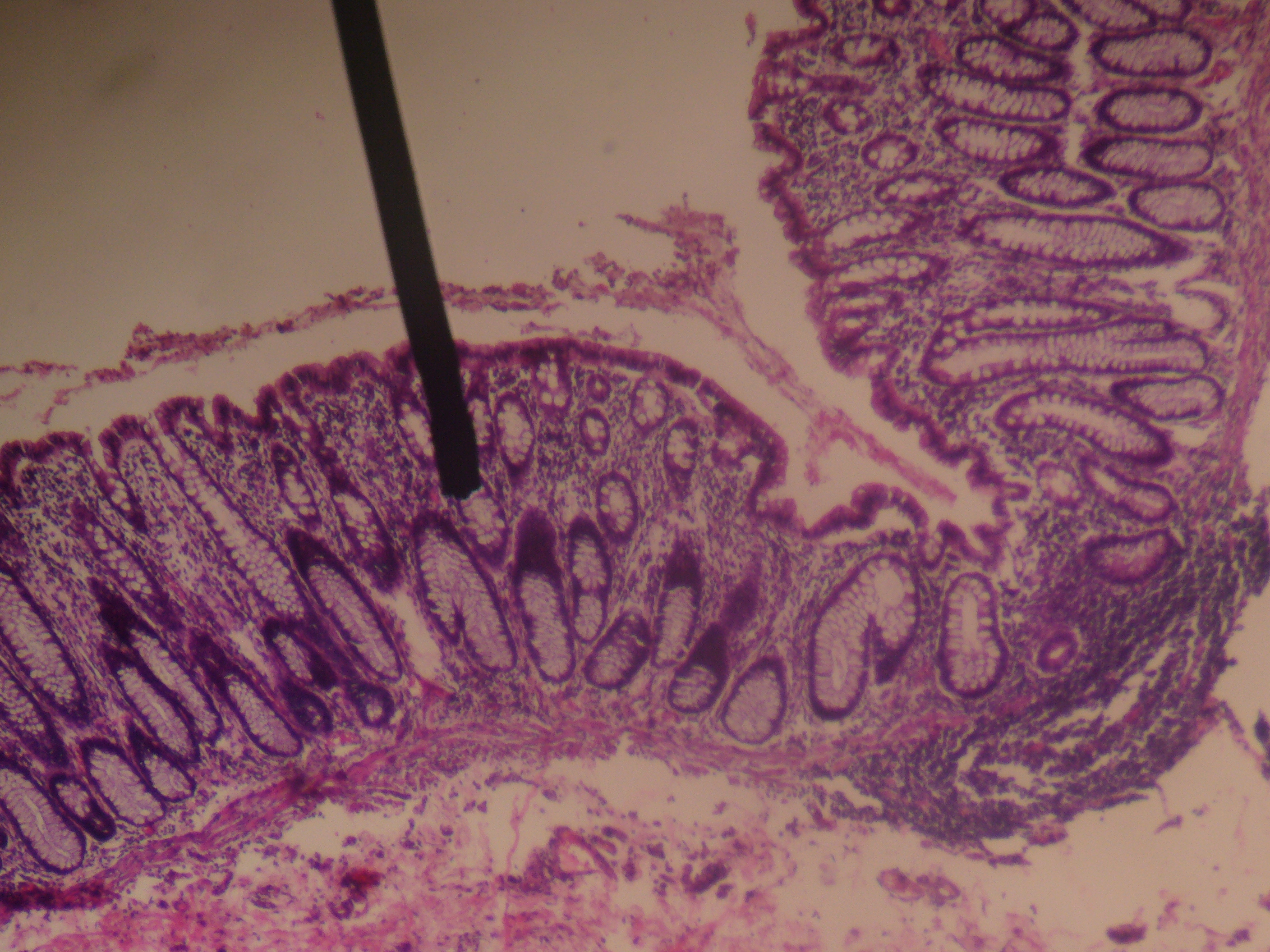 Cross section microscopic shot of the rectal wall.