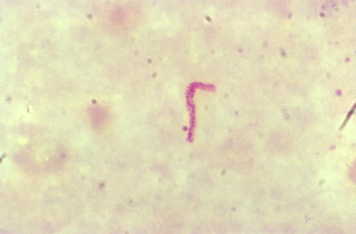 Gram-negative Haemophilus ducreyi bacteria. From Public Health Image Library (PHIL). [6]