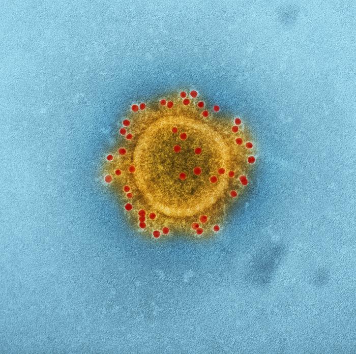 Middle East Respiratory Syndrome Coronavirus (MERS-CoV) virion. From Public Health Image Library (PHIL). [1]