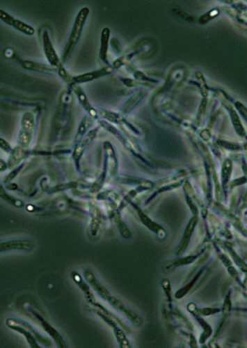 "Bacillus anthracis spores seen under phase contrast microscopy”Adapted from Public Health Image Library (PHIL), Centers for Disease Control and Prevention.[21]