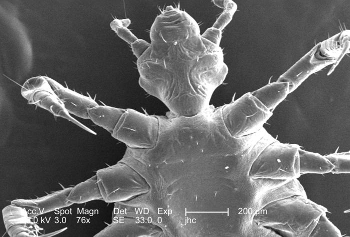 Scanning electron micrographic (SEM) image focused on the head region of a female body louse, Pediculus humanus var. corporis from a ventral perspective. SEM reveals some of the insect’s exoskeletal morphology exhibited by its cephalic, or head region, thoracic, and proximal abdominal regions. From Public Health Image Library (PHIL). [1]