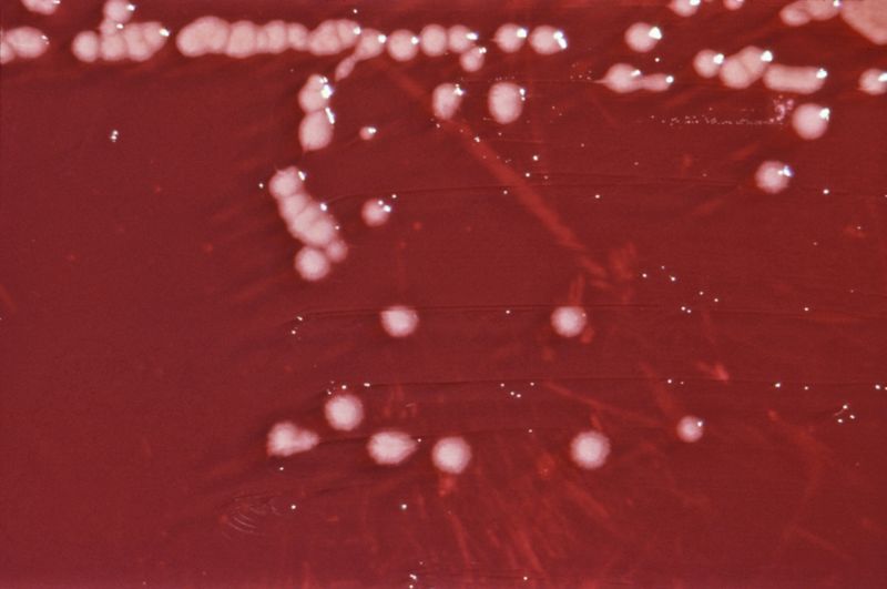 P. aeruginosa colonies on an agar plate.