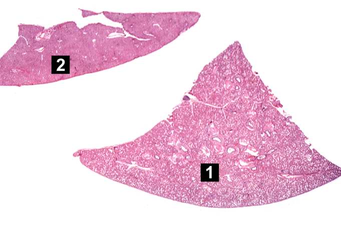 This is a low-power photomicrograph of a triangular-shaped section of lung (1) and an oblong section of liver (2). The lack of open air spaces in this neonatal lung indicates its immaturity.