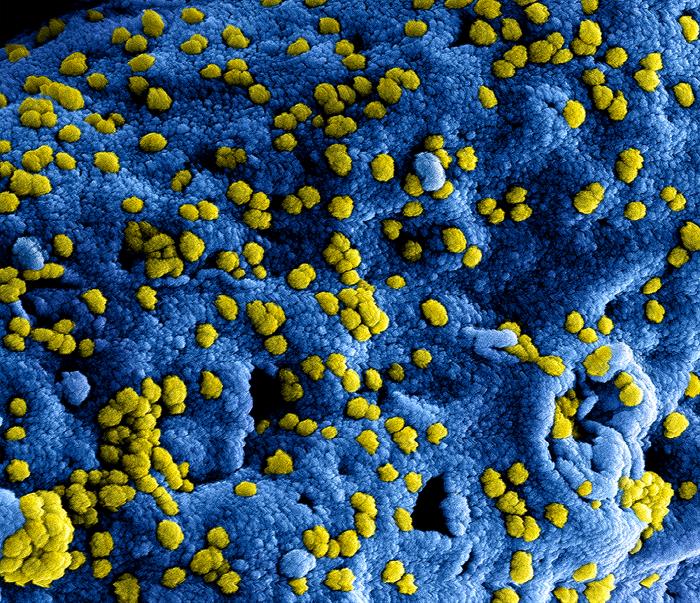 SEM reveals ultrastructural details at the site of interaction of numerous yellow-colored Middle East respiratory syndrome Coronavirus (MERS-CoV) viral particles on the surface of a Vero E6 cell (blue). From Public Health Image Library (PHIL). [1]