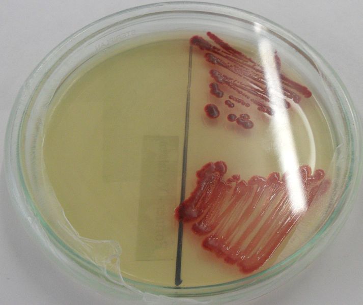 Serratia marcescens appears as bloody red spots on culture medium. From WikiMedia.org. [6]