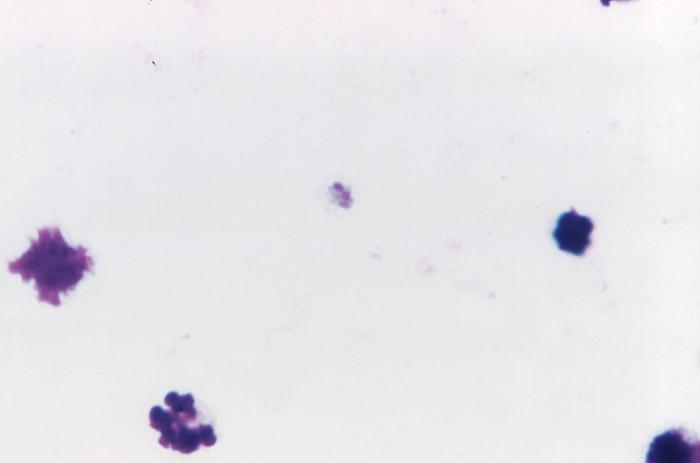 Magnified 1125X, this photomicrograph revealed the presence of a Plasmodium malariae immature schizont. Adapted from Public Health Image Library (PHIL), Centers for Disease Control and Prevention.[6]