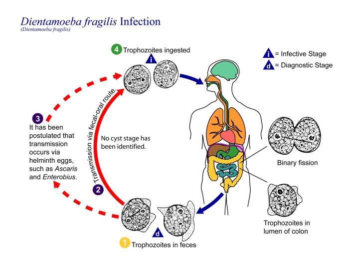 Illustration of the assumed life cycle of Dientamoeba fragilis, the cause of a protozoan parasitic infection. From Public Health Image Library (PHIL). [2]