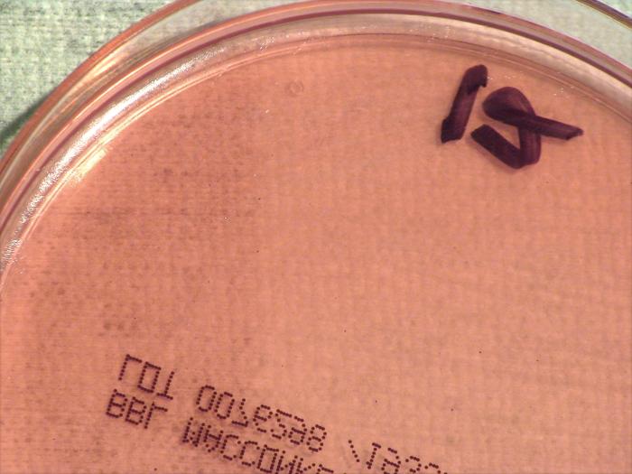 Light colonial growth displayed by Gram-positive, Pasteur strain, Bacillus anthracis bacteria, which was grown on a medium of MacConkey agar, for a 24 hour time period, at a temperature of 37°C. ”Adapted from Public Health Image Library (PHIL), Centers for Disease Control and Prevention.[20]