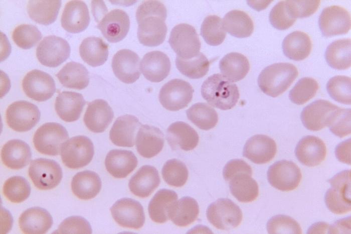 Magnified 1125X, this thin film photomicrograph of a blood smear, revealed the presence of a ring-formPlasmodium vivax trophozoite on the right, which contained three chromatin dots Adapted from Public Health Image Library (PHIL), Centers for Disease Control and Prevention.[6]