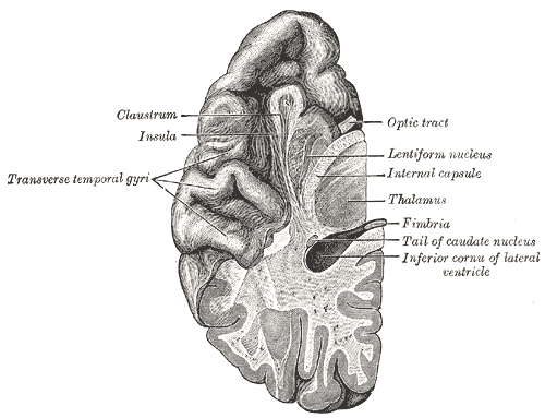 Section of brain showing upper surface of temporal lobe.