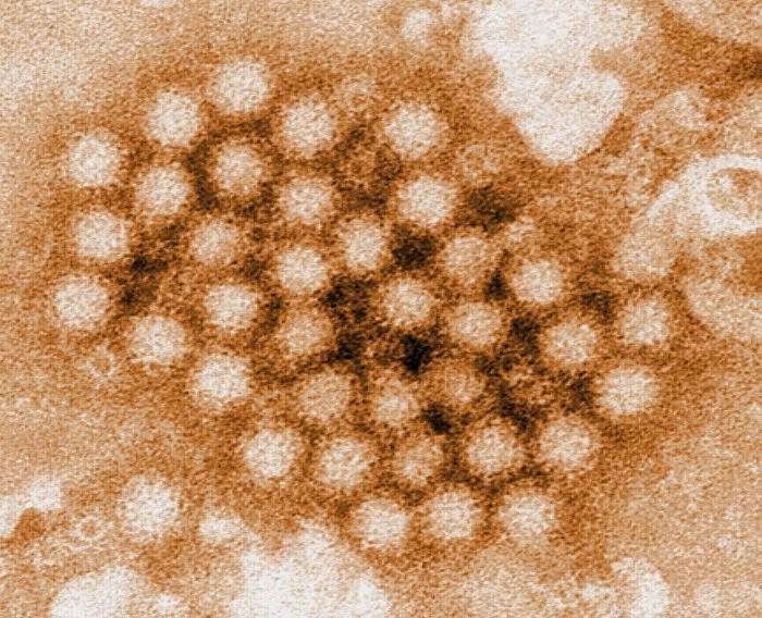 Transmission electron micrograph (TEM) revealed some of the ultrastructural morphology displayed by Norovirus virions. From Public Health Image Library (PHIL). [21]