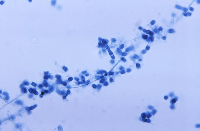 Photomicrograph reveals presence of numerous thick-walled Coccidioides immitis arthroconidia and arthrospores (500x mag). From Public Health Image Library (PHIL). [5]