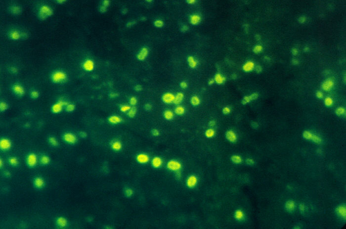 Photomicrograph of Haemophilus influenzae using immunofluorescence. From Public Health Image Library (PHIL). [9]
