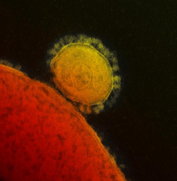 TEM reveals ultrastructural details exhibited by a single, spherical-shaped Middle East Respiratory Syndrome Coronavirus (MERS-CoV) virion. From Public Health Image Library (PHIL). [1]